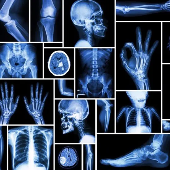 What Are Different Types Of X-Rays?